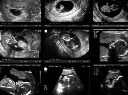 惠州试管婴儿医院哪家做的好？这家医院千万别错过！